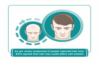 Best Doctor For Hair Transplant In Mumbai