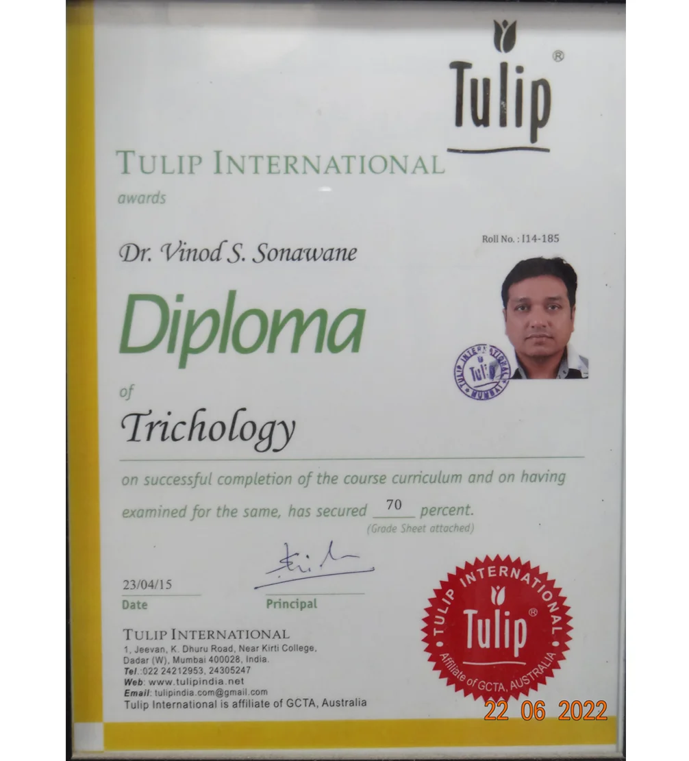 india hair transplant cos