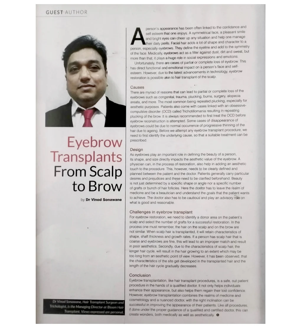 top hair transplant doctors in india