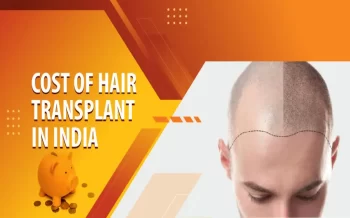 What Is The Cost Of A Hair Transplant In India?