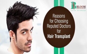 Why To Choose Reputed Doctors For Hair Transplant?