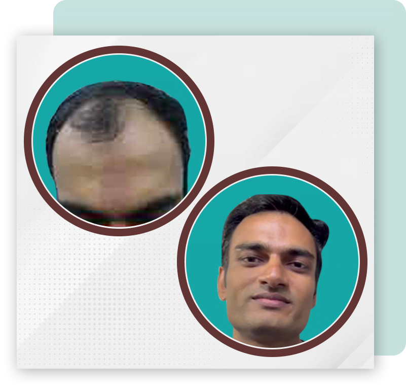 hair doctor in mumbai