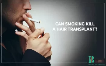 Can smoking kill a hair transplant?