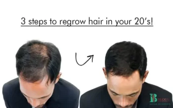 3 steps to regrow hair in your 20’s!