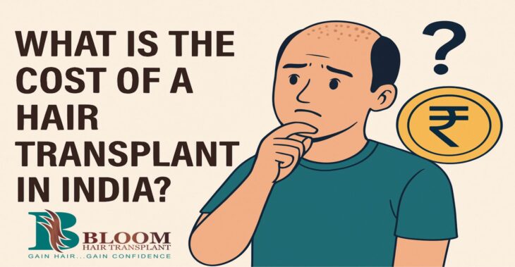 What Is The Cost Of A Hair Transplant In India?