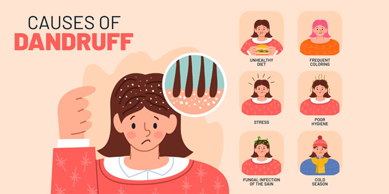 major reasons for hair fall