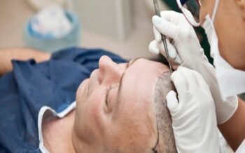 What Is the Ideal Time to Undergo Hair Transplant Surgery?