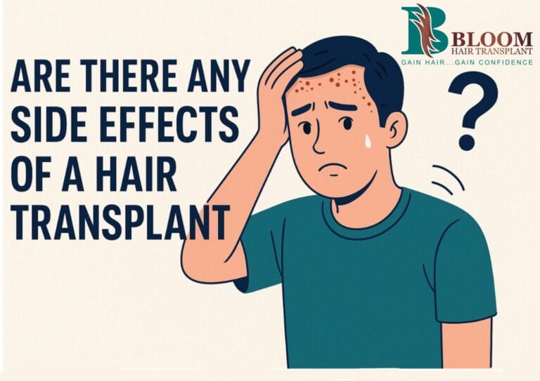 Are There Any Side Effects of Hair Transplant