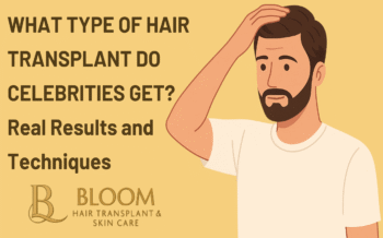 What Type of Hair Transplant Do Celebrities Get? Real Results and Techniques