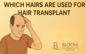 Which Hairs Are Used for Hair Transplant? The Complete Guide for Patients