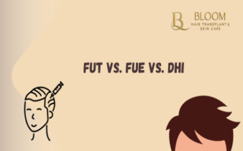 FUT vs. FUE vs. DHI: Hair Transplant Techniques for the Modern Patient