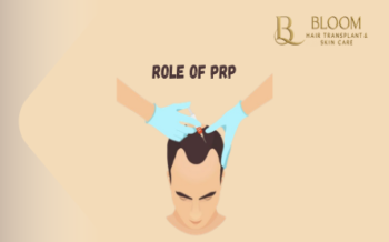 The Role of PRP (Platelet-Rich Plasma) Therapy in Hair Transplant Success