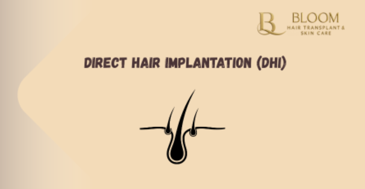 Direct Hair Implantation (DHI): The Gold Standard for Density and Natural Hairlines?
