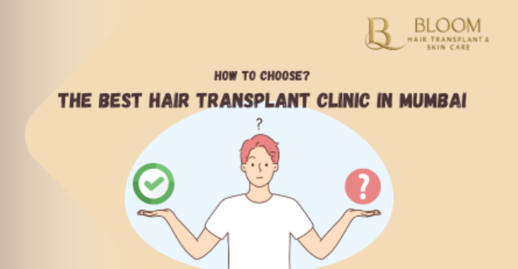 How to Choose the Best Hair Transplant Clinic in Mumbai: A 10-Point Checklist