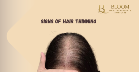 Subtle Signs of Hair Thinning You Shouldn’t Ignore