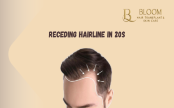 Receding Hairline in 20s: Early Warning Signs Men Should Know