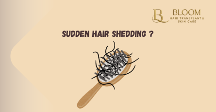 Sudden Hair Shedding After Illness: Red Flags You Should Not Ignore