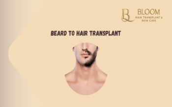 Beard to Hair Transplant: Using Facial Hair for Scalp Restoration