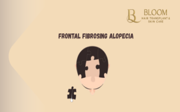 Frontal Fibrosing Alopecia: Understanding Slow-Progressing Hair Loss