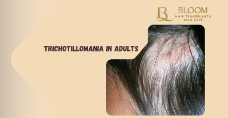 Trichotillomania in Adults: Stress-Related Hair Pulling Explained