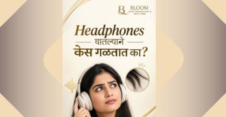 Can Wearing Headphones Cause Hair Loss?